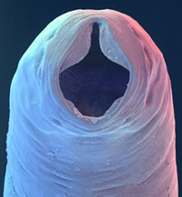 hookworm